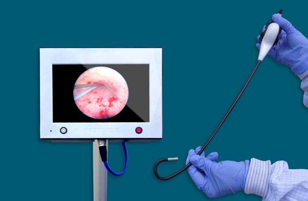 Ανώδυνη κυστεοσκόπηση