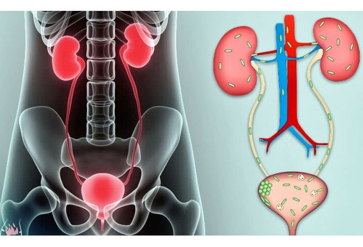 Ουρολοιμώξεις