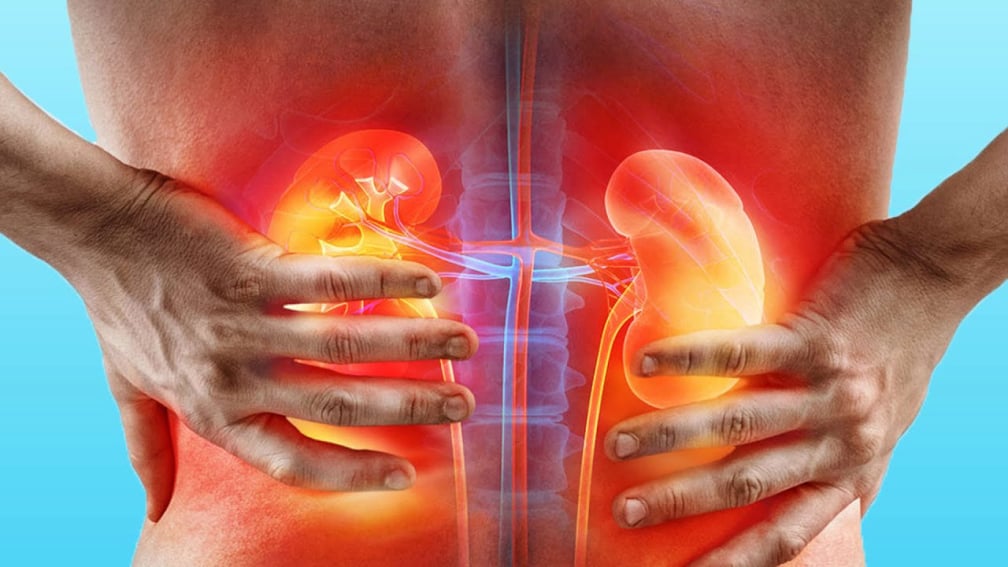 Κολικός Νεφρού