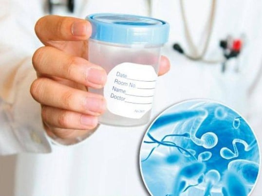 Σπερμογραφία