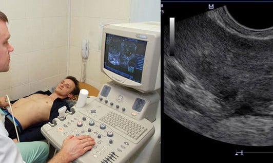 Πλήρης διερεύνηση με υψηλής ευκρίνειας υπέρηχο